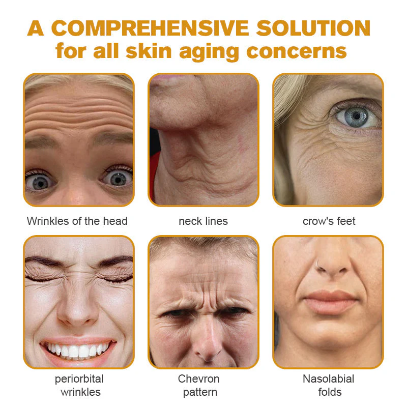 đ¨ââď¸ Botox Bee Venom Wrinkle Removal Cream- LAST DAY 70% OFFâ