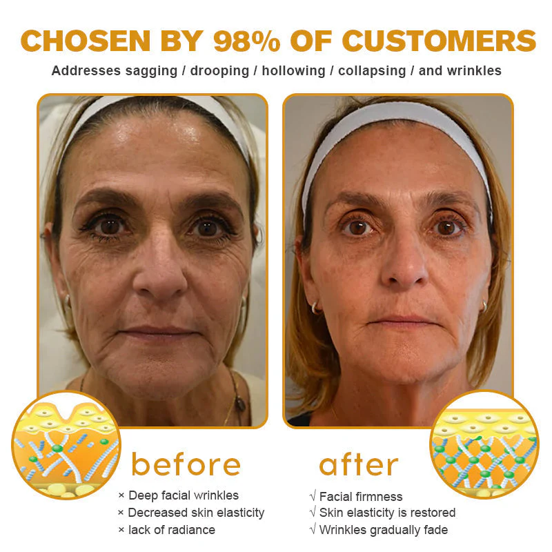 đ¨ââď¸ Botox Bee Venom Wrinkle Removal Cream- LAST DAY 70% OFFâ