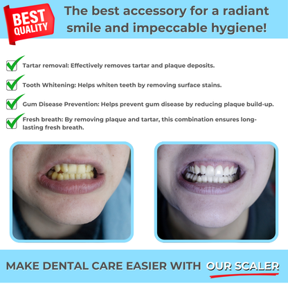 HEALIX | Dental Remover for perfect oral hygiene