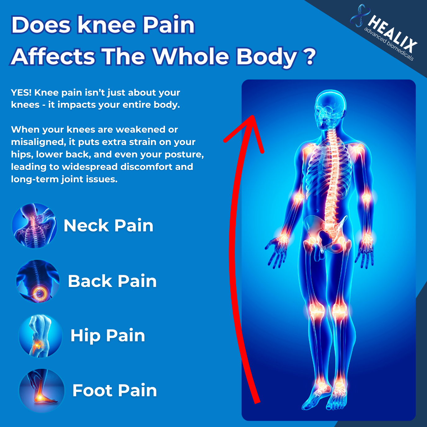 BioSupport Orthopaedic Knee Brace for Pain Relief (Buy One, Get One Free)