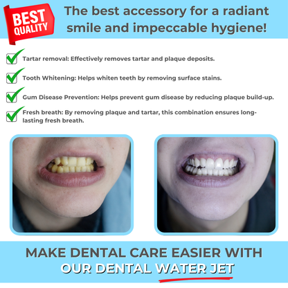 HEALIX | Water Flosser for perfect oral hygiene